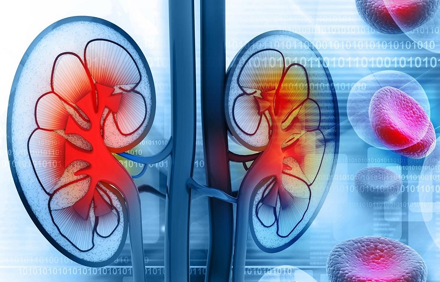 Effects Of Chronic Kidney Diseases On Human Eyes